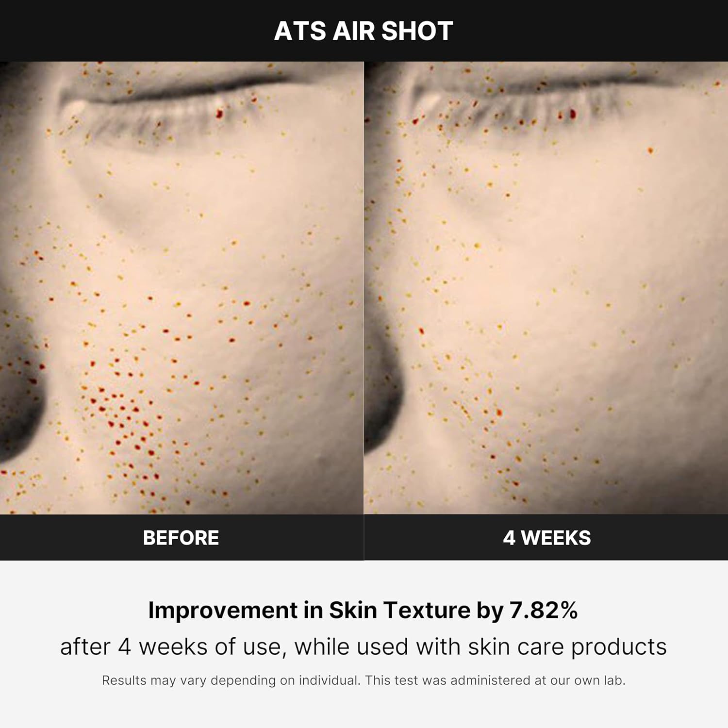 Medicube Age-R ATS Air Shot - Microneedling Pore Tightening Skin Care Device wourant