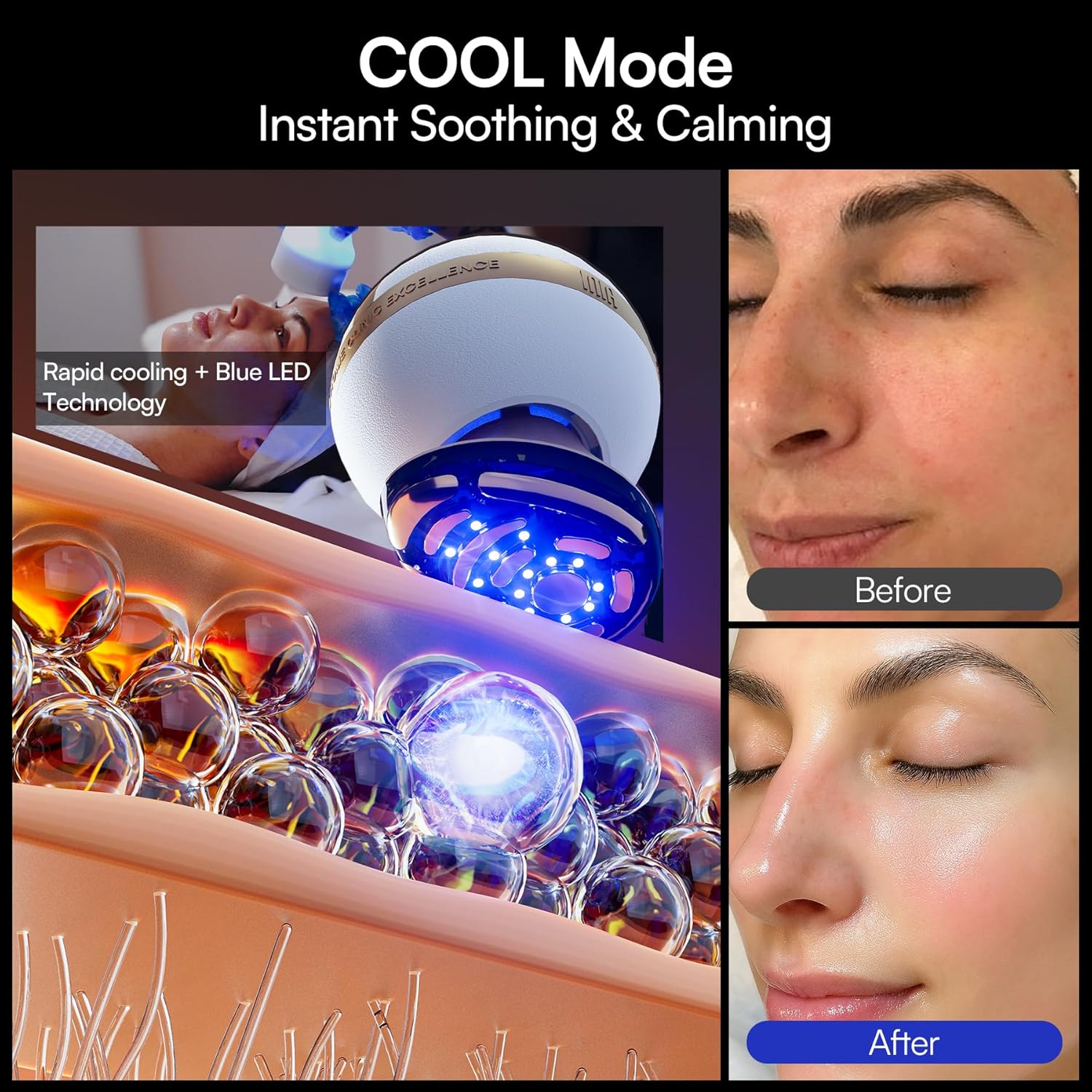 INIA SPHERA Upgraded 8-in-1 Microcurrent Facial Device for Face & Neck Red Light wourant