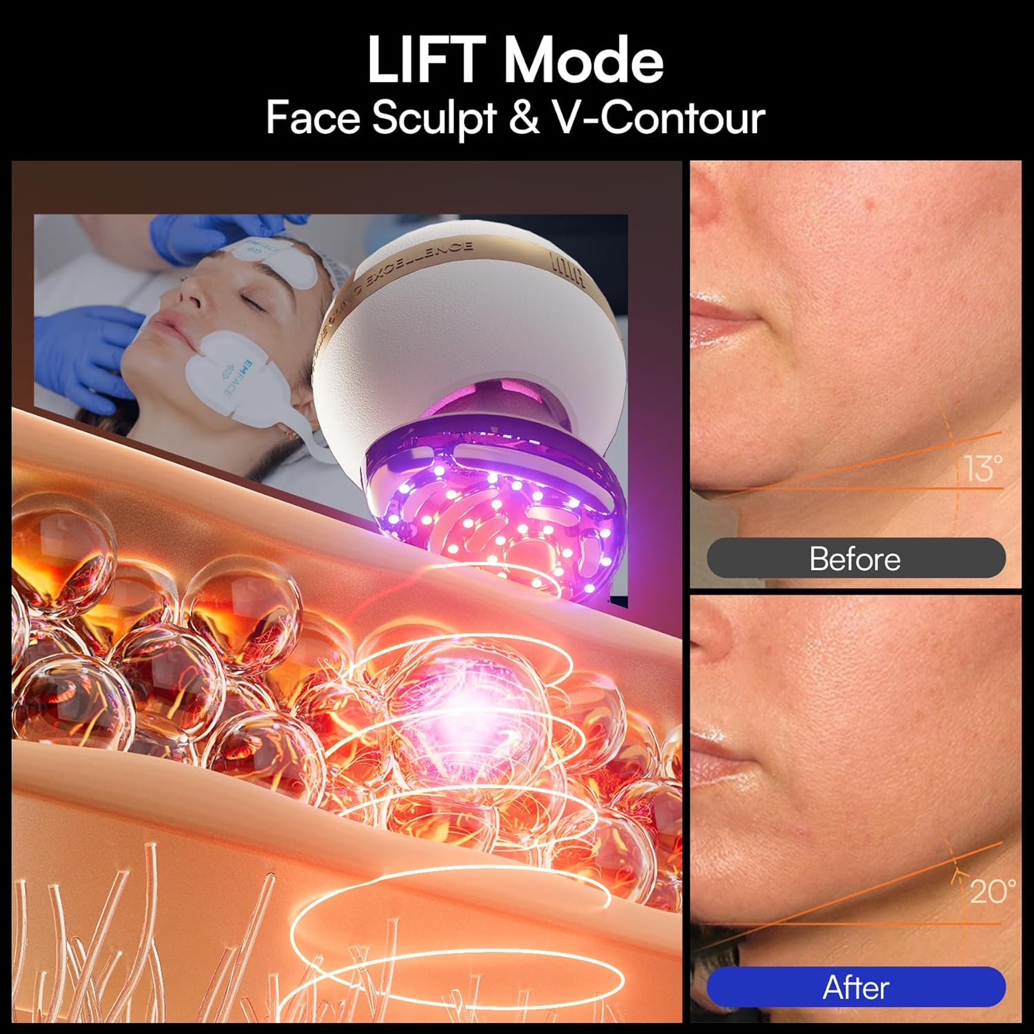 INIA SPHERA Upgraded 8-in-1 Microcurrent Facial Device for Face & Neck Red Light wourant